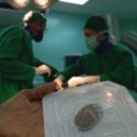 Proyecto solidario 2025 de Mollet amb Cuba recauda 4.000 euros para la compra de marcapasos para la Isla